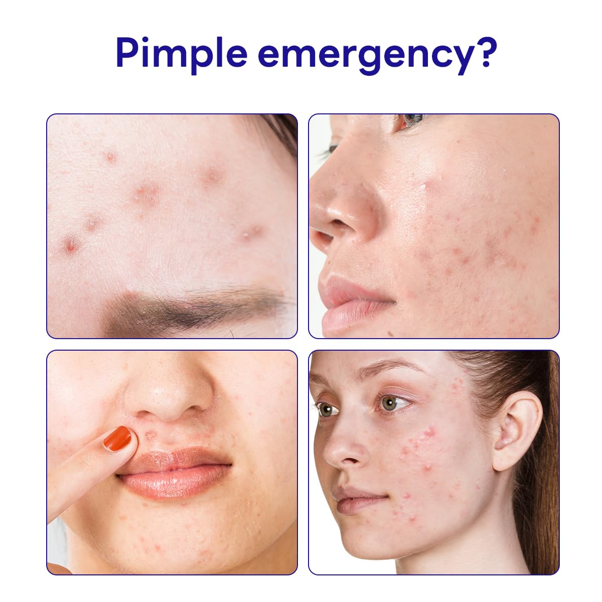 MEDIHEAL Derma Clear Madecassoside Spot Patch (44pcs)