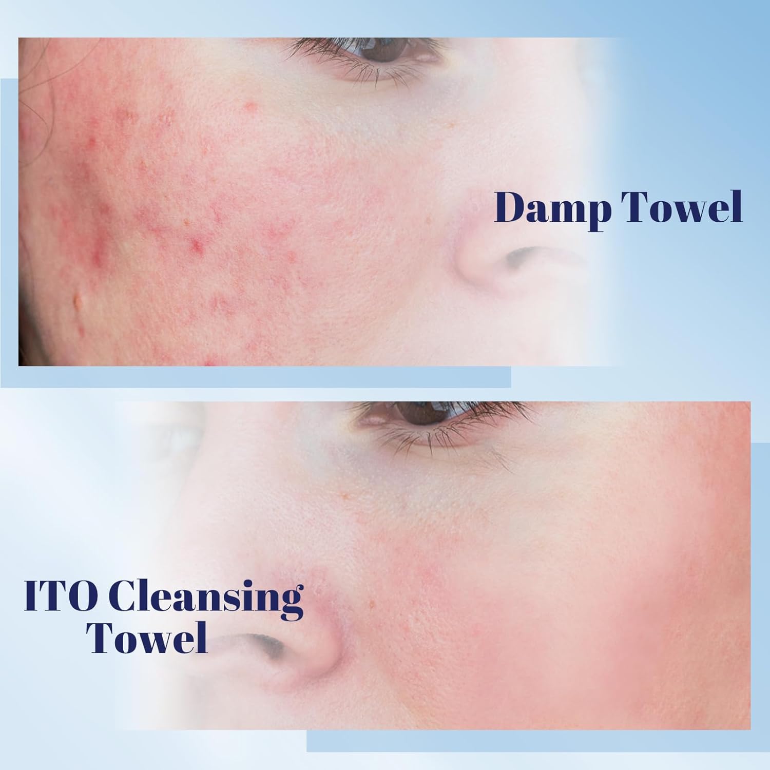ITO Disposable Cleansing Towel