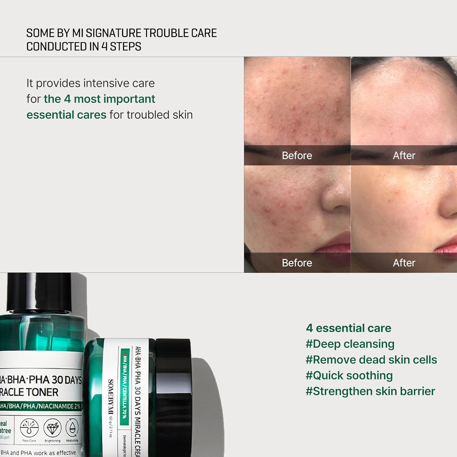 SOME BY MI AHA-BHA-PHA 30 Days Miracle Starter Kit