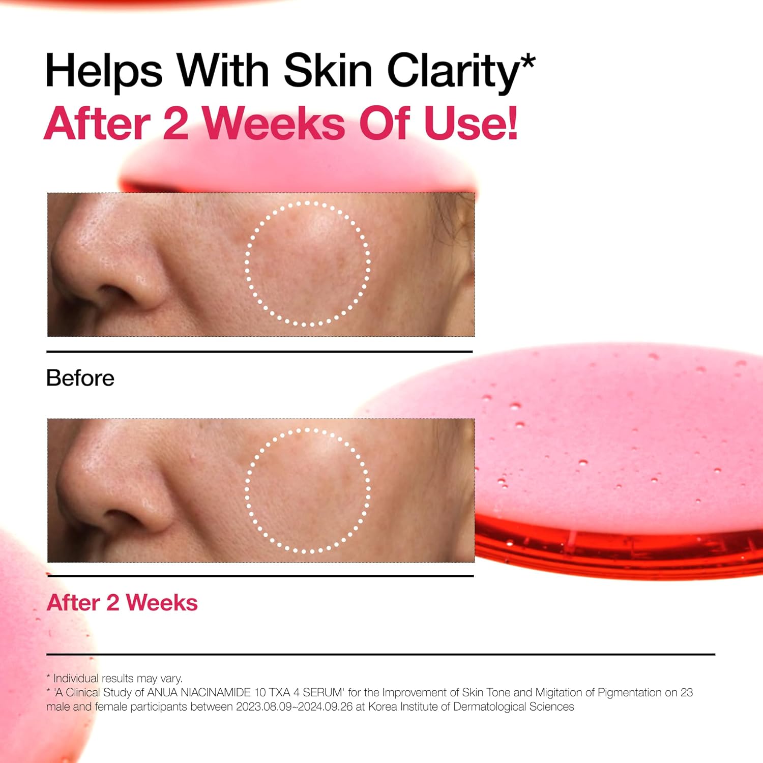 Anua Niaciamide 10% + TXA 4% Serum 30ml/1.01 fl.oz