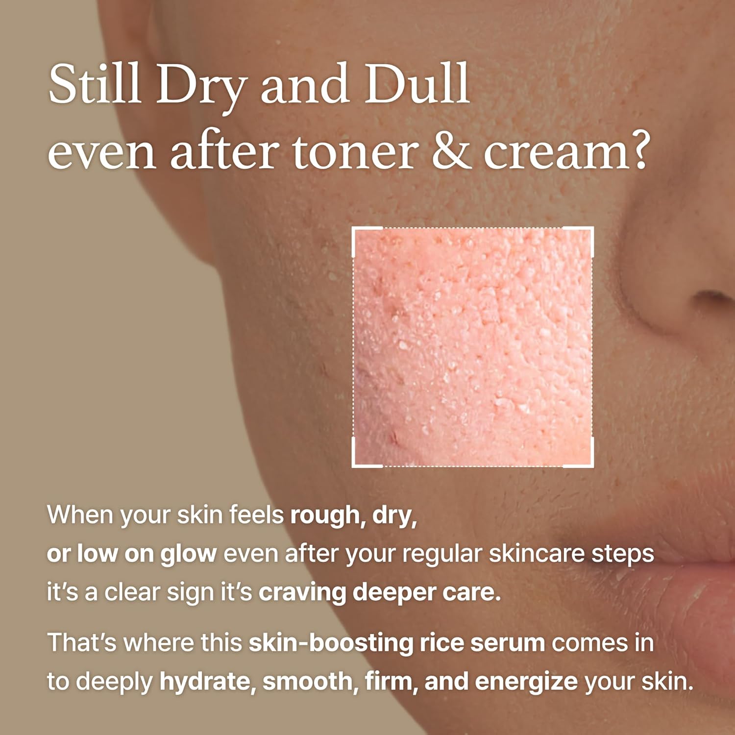 I'm From Rice Serum 30ml