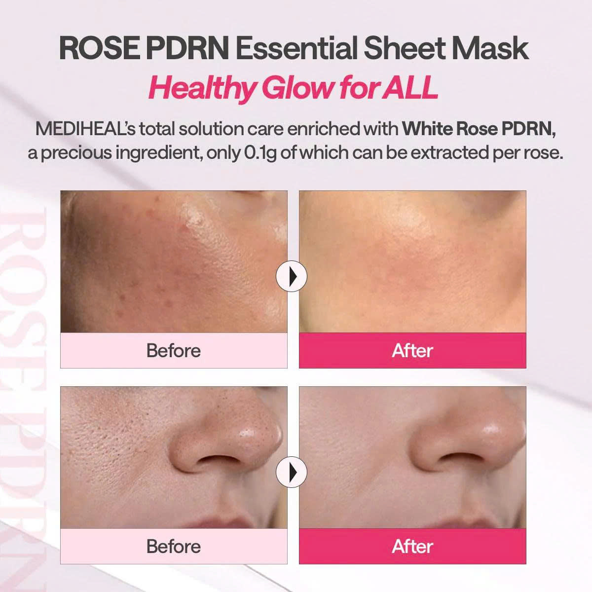 MEDIHEAL Rose PDRN Essential Mask
