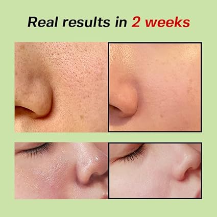 SUNGBOON EDITOR Green Tomato Pore Lifting Ampoule+ 75ml