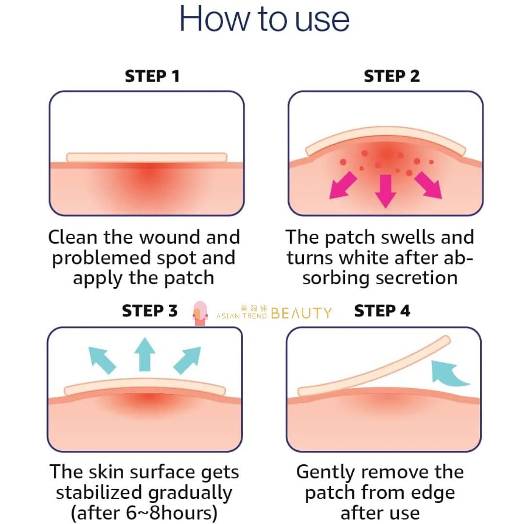 Patchs anti-cicatrices Care Plus, 102 pièces