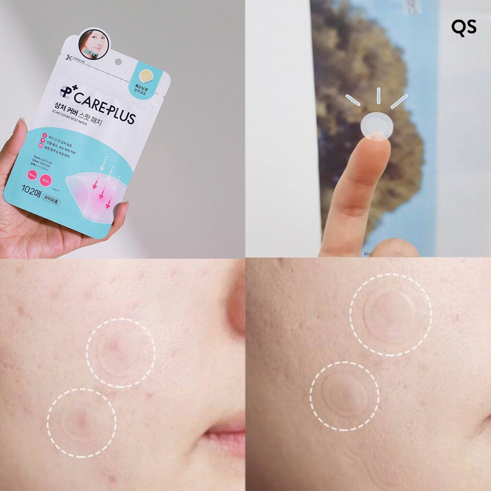 Patchs anti-cicatrices Care Plus, 102 pièces