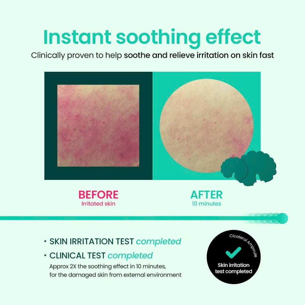 Bộ ống tiêm Beplain Cicaterol 30ml + 31ml Refill